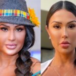 Imagem do post Gracyanne Barbosa mudou o rosto? Vem saber mais sobre o procedimento realizado pela musa fitness